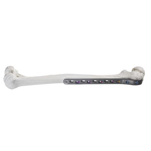 femur compression plate