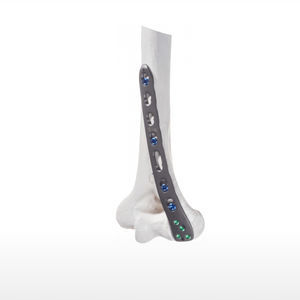 humerus compression plate