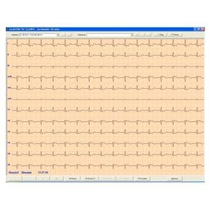 electrocardiography software