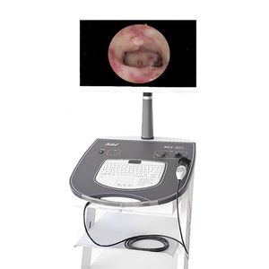 arthroscopic endoscopy column