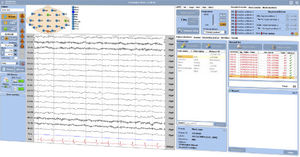 EEG software 1