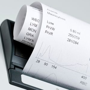 3-part differentiation hematology analyzer / 22-parameter / for humans / with touchscreen