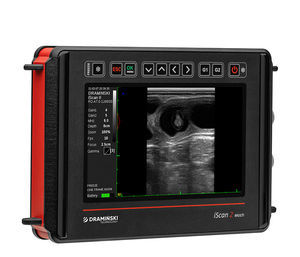portable ultrasound system 1