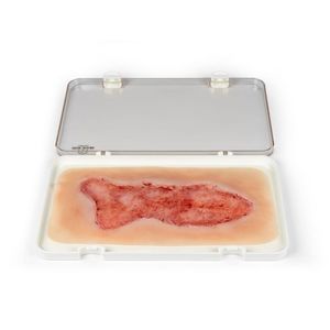 wound management simulator 1