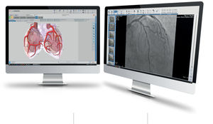 cardiology software