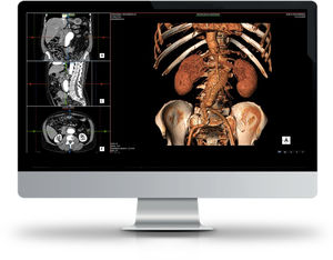 medical imaging software