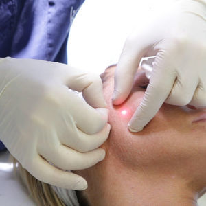 skin rejuvenation laser