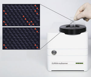 dermatological infection test kit