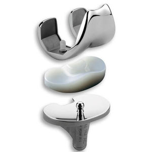 mobile-bearing knee prosthesis