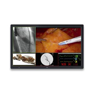 medical display 1