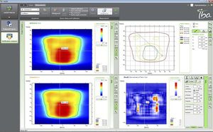 radiation therapy software