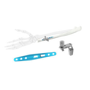 ulna compression plate 1