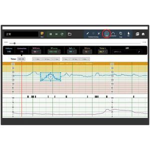 fetal monitor simulator 1