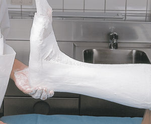plaster casting tape