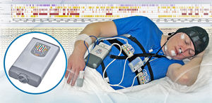 polysomnograph with EEG