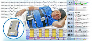 ambulatory polysomnograph