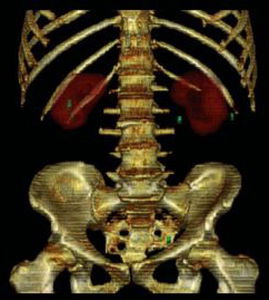 urology software