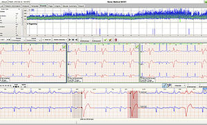 cardiac Holter monitor software