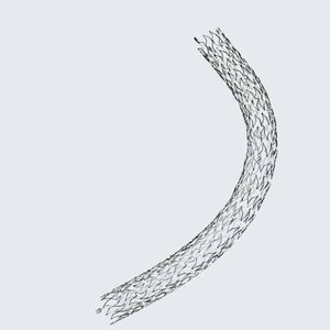 peripheral stent