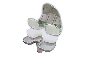 three-compartment knee prosthesis
