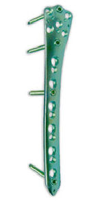 femur compression plate