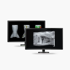 bone densitometry software