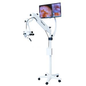 video colposcope