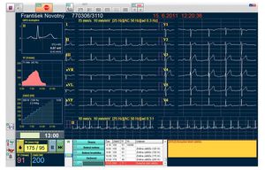 electrocardiography software module