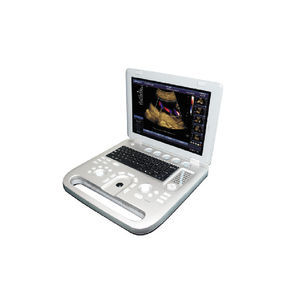 portable ultrasound system 1