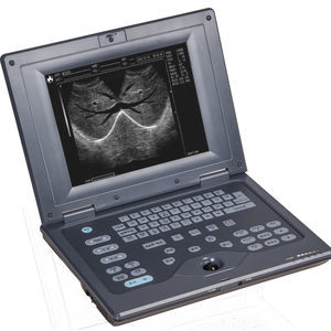 portable ultrasound system