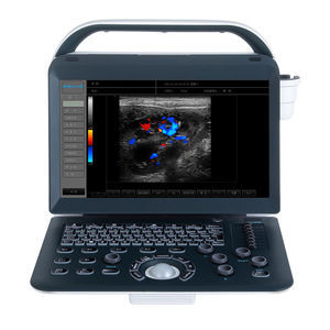 portable ultrasound system