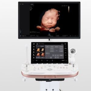 on-platform ultrasound system 1