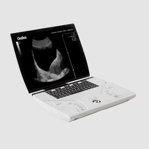 portable, with trolley ultrasound system