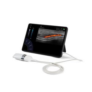 linear-array ultrasound transducer 1