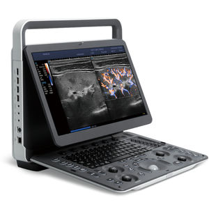 portable ultrasound system 1