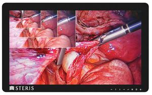 surgical display