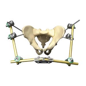 modular external fixation system