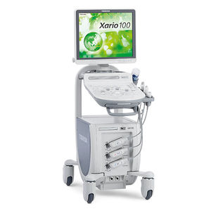 on-platform ultrasound system