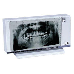 1-screen X-ray film viewer