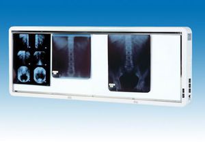 4-screen X-ray film viewer