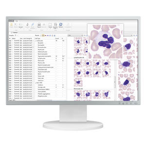 automatic cell imaging system