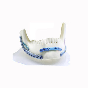 mandible compression plate