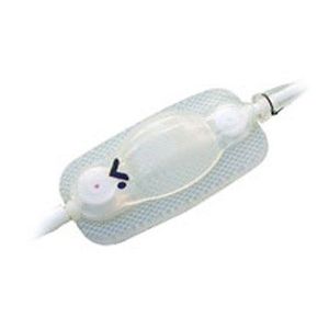 adjustable pressure hydrocephalus shunt valve