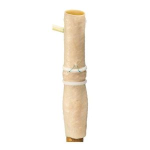 pulmonary artery vascular bioprosthesis