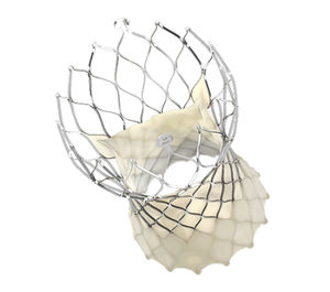 aortic valve bioprosthesis