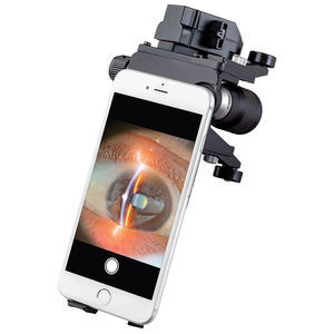 digital slit lamp