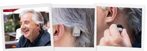 internal component bone conduction hearing implant / body-worn processor / removable