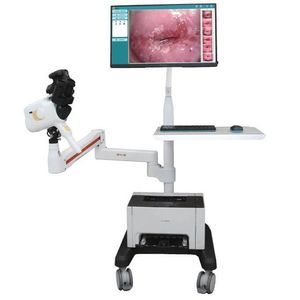 digital colposcope