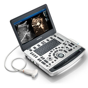 portable ultrasound system
