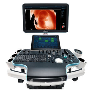 on-platform ultrasound system